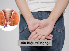 Dấu hiệu trĩ ngoại
