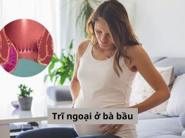 Trĩ ngoại ở bà bầu