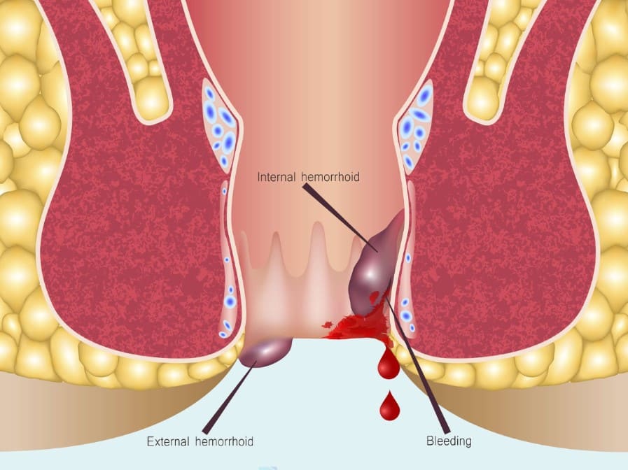 Nhận biết triệu chứng của bệnh