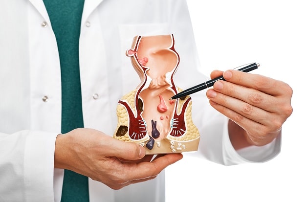 Nguyên nhân dẫn đến bệnh trĩ đại tiện ra máu