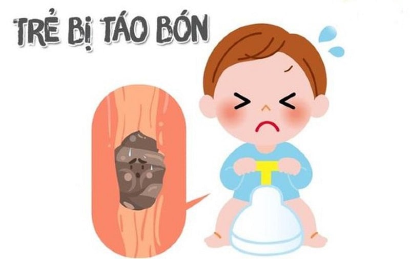 Điểm mặt những triệu chứng khi trẻ bị trĩ