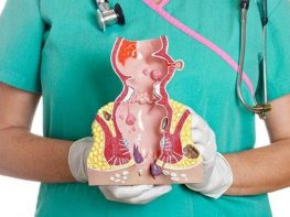 Các cấp độ trĩ ngoại