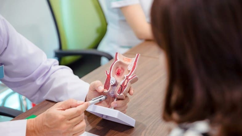 Vì sao phải can thiệp điều trị trĩ ngoại từ sớm?