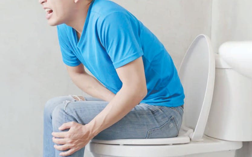 Dấu hiệu trĩ ngoại: Táo bón