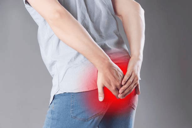 Dấu hiệu trĩ ngoại: Đau rát hậu môn