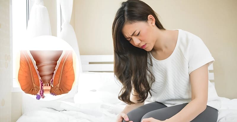 Trĩ ngoại sau sinh có nguy hiểm không?