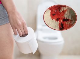 Chảy máu nhẹ khi đi đại tiện