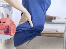 Dấu hiệu trĩ nội