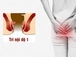 Trĩ nội độ 1