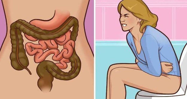 Ung thư trực tràng được xem là bệnh lý nguy hiểm nhất tại khu vực hậu môn.