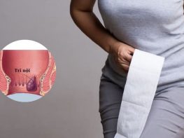 Các cấp độ trĩ nội