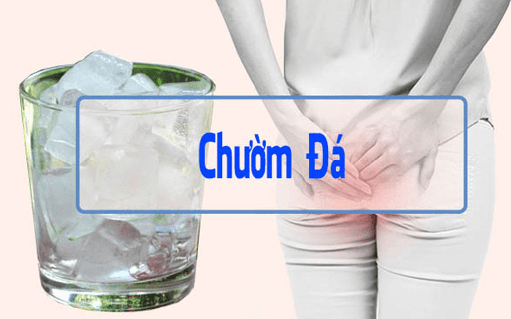 Chữa bệnh trĩ bằng đá lạnh