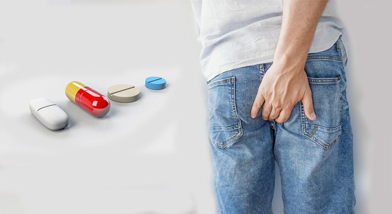 Nguyên tắc cụ thể khi điều trị bệnh trĩ bằng thuốc tây
