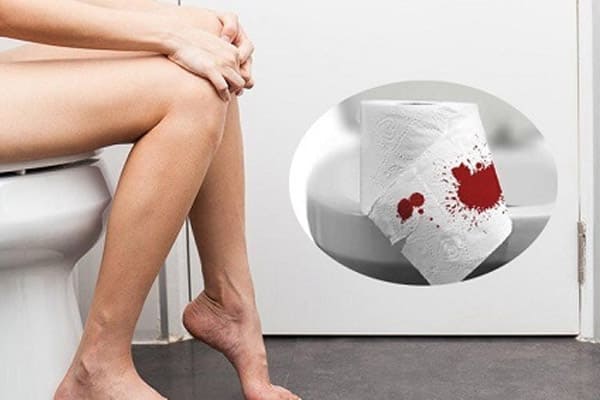 Trĩ nội chảy máu nguy hiểm như thế nào?