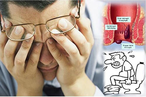 Ảnh hưởng đến chất lượng cuộc sống