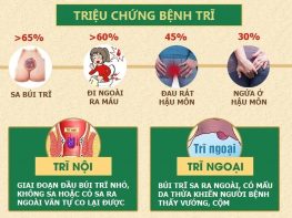 Nhận diện nhanh những triệu chứng bệnh trĩ điển hình
