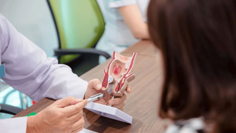 Điều trị bệnh trĩ nội