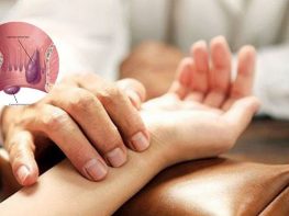 Chữa bệnh trĩ bằng Đông y ở Hà Nội
