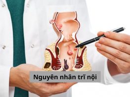 Nguyên nhân trĩ nội