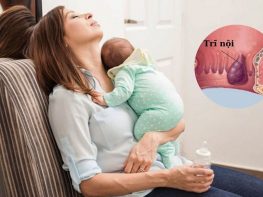 Sau sinh bị trĩ nội