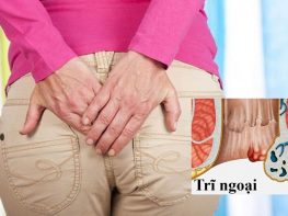 Trĩ ngoại độ 1