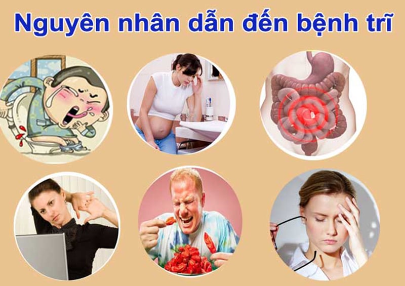 Nguyên nhân hình thành nên bệnh trĩ cần phải cảnh giác