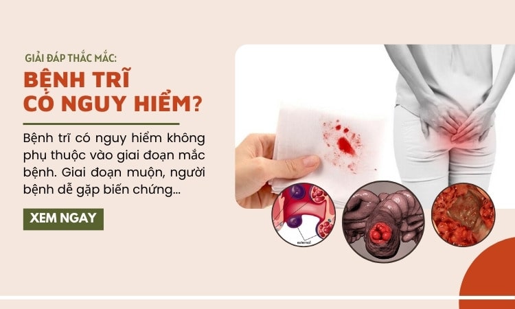 Bệnh trĩ có nguy hiểm không? 6 biến chứng thường gặp của bệnh trĩ
