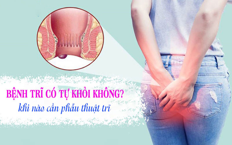 Bệnh trĩ có tự hết không? Có khỏi được không?