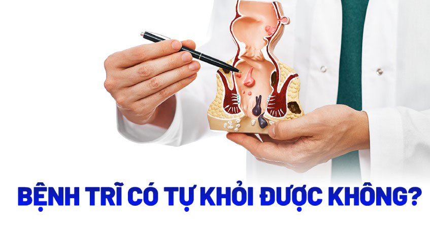 Bệnh trĩ có tự khỏi không? Nguy hiểm ra sao?