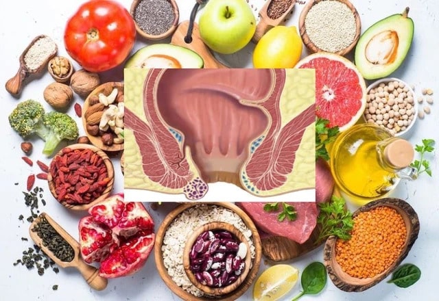 Chế độ dinh dưỡng và mối liên hệ với bệnh trĩ