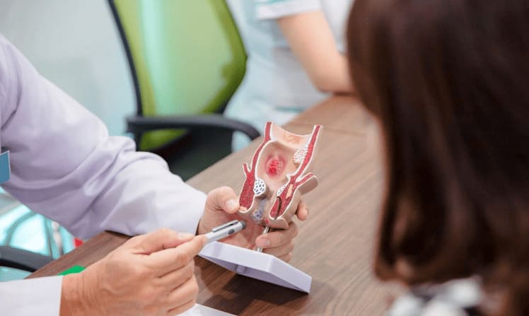 Công tác chẩn đoán tình trạng trĩ nội độ 4