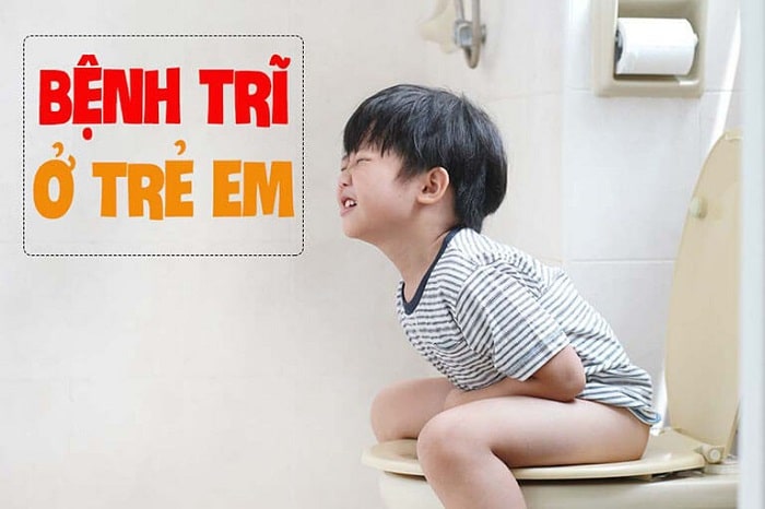 Bệnh trĩ ở trẻ em được hiểu là gì?