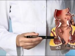Lý giải nguyên nhân bệnh trĩ tái phát dù đã được điều trị 