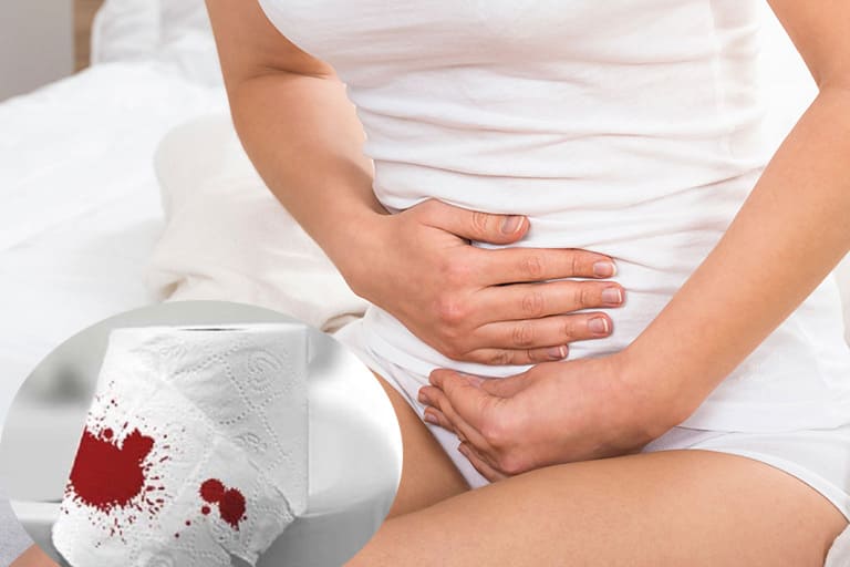 Thắt trĩ nội có nguy hiểm không? - Chảy máu hậu môn