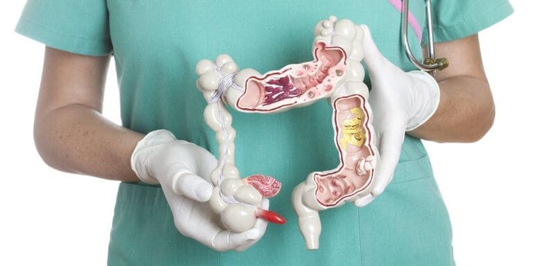 Trĩ ngoại độ 2 có phải bệnh nguy hiểm không?