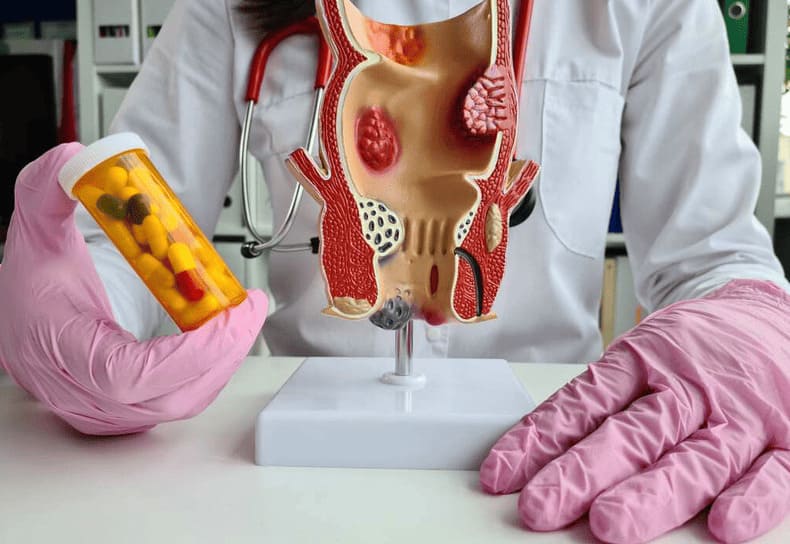 Nhận định về ý kiến trĩ ngoại giai đoạn đầu không cần can thiệp phẫu thuật