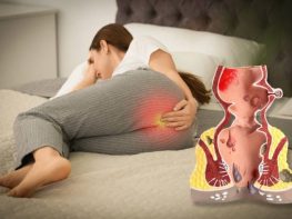 Trĩ nội có nguy hiểm không?