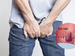 Đau trĩ nội