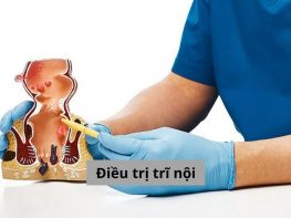 Điều trị trĩ nội