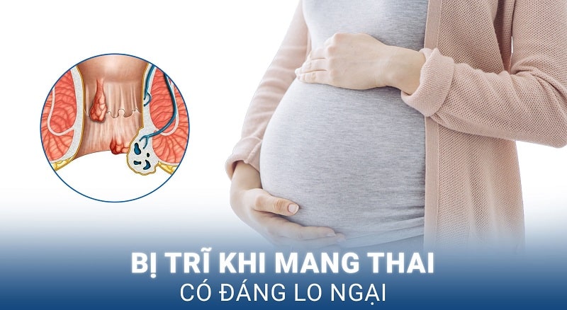 Bà bầu khi mắc trĩ liệu có sinh thường được không ?