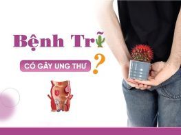Giải đáp: Bệnh trĩ có gây ung thư không ?