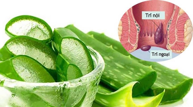 Bệnh trĩ có nên ăn nha đam không?