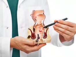 Nên hay không khám bệnh trĩ tại các bệnh viện lớn ở Hà Nội ?