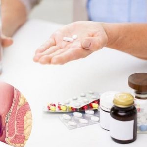 Bệnh trĩ nội nên uống thuốc gì
