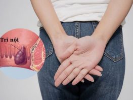Cách làm giảm đau trĩ nội