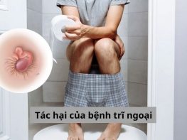 Tác hại của bệnh trĩ ngoại