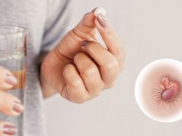Trĩ ngoại uống thuốc có khỏi không?