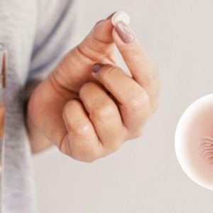 Trĩ ngoại uống thuốc có khỏi không?