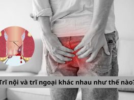 Trĩ nội và trĩ ngoại khác nhau như thế nào?