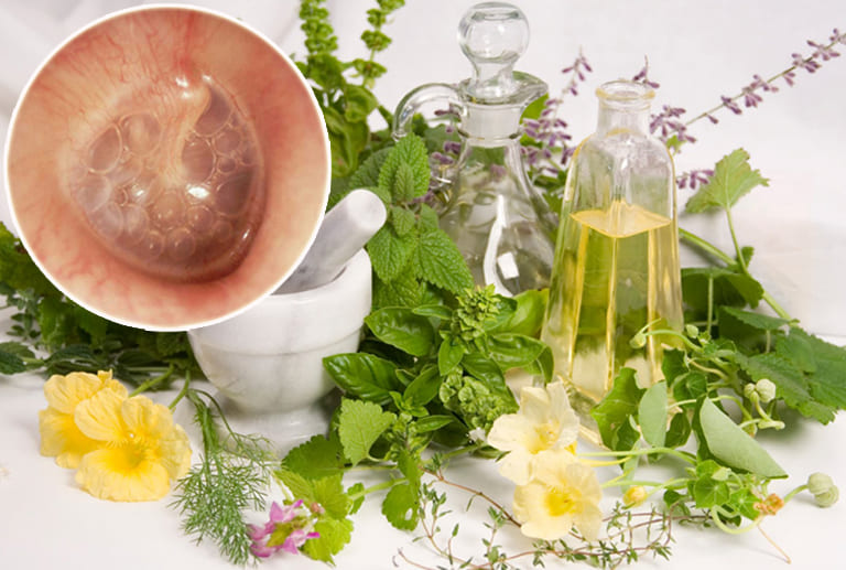 Giảm đau trĩ nội với các mẹo dân gian
